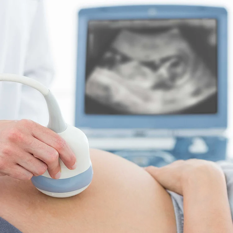 ultrasound-diagnostic